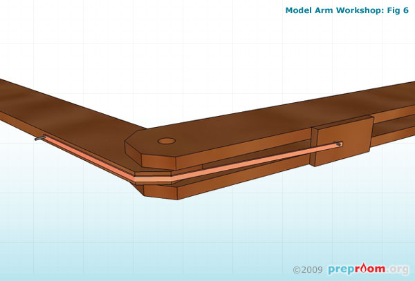 Fig 6: Lower band in place